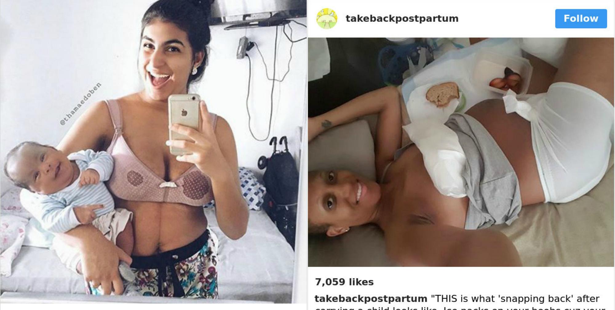 20 честных фотографий о том, что происходит с телом после родов. Именно об этом и умалчивает общество