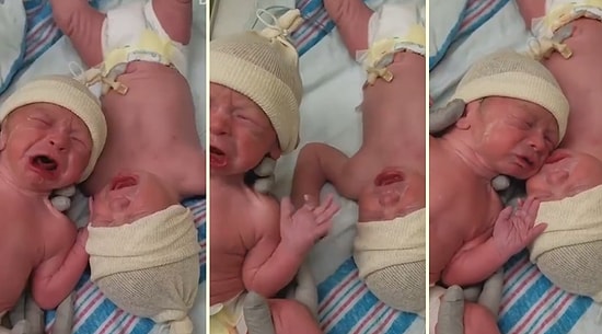 Yeni Doğmuş İkizlerin Birbirinden Ayrılmak İstemedikleri Muhteşem Anlar