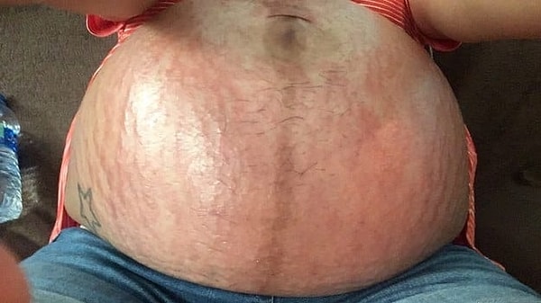 2. Вот так и выглядит та самая, негламурная сторона беременности...