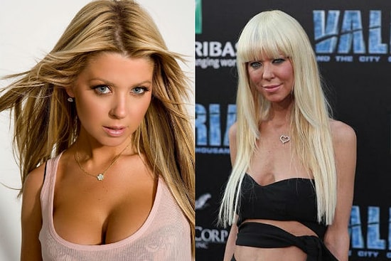 Шило на мыло: 10 звезд, которых состарила пластика