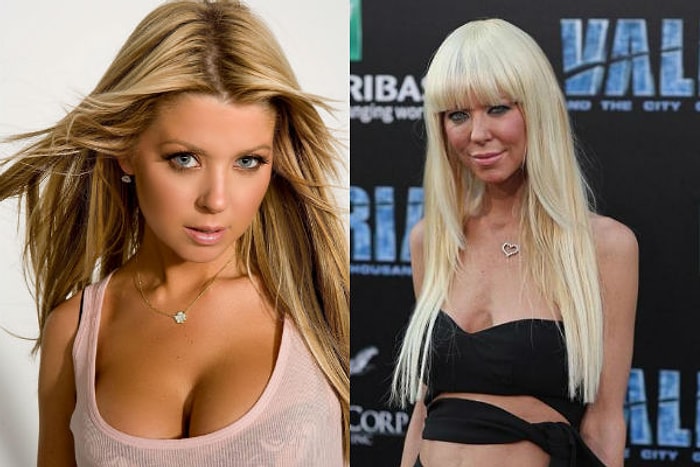 Шило на мыло: 10 звезд, которых состарила пластика