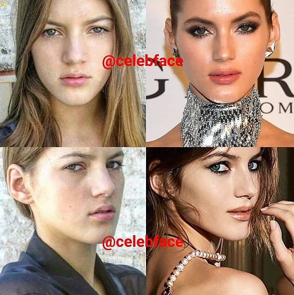 5. Нужна ли была пластика ей?