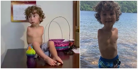 Kolları Olmadığı İçin Ayaklarıyla Yemek Yemesine (Hijyenik Sebepler!) Nedeniyle İzin Verilmeyen Çocuk