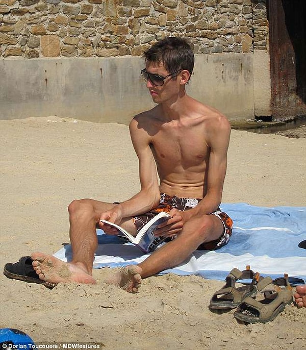 2. У Дориана Тукёра развилась фудофобия, он сильно похудел, а также страдал от депрессии и одиночества.