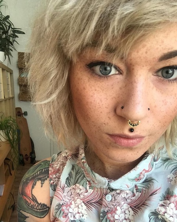 1. Что скажете об этих веснушках?