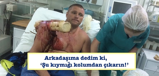 Kullandığı Uçak Ormana Düşünce Omzuna Bir Ağaç Saplanan Adamın İnanması Güç Umursamazlığı