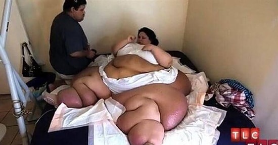 Obezite Sonucu 500 Kiloya Ulaşan Marya'nın 90 Kiloya İnip Yeniden Hayata Tutunma Hikayesi