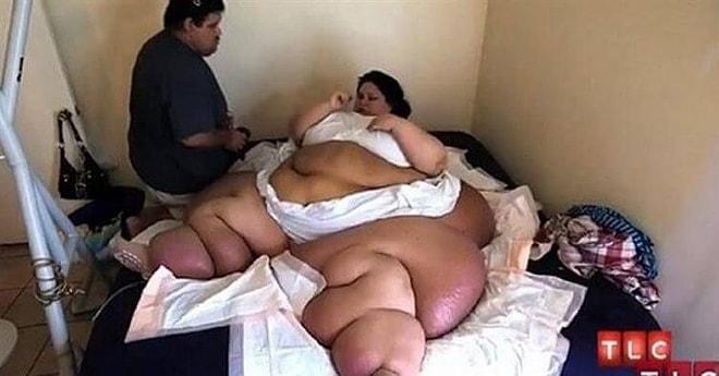 Obezite Sonucu 500 Kiloya Ulaşan Marya'nın 90 Kiloya İnip Yeniden Hayata Tutunma Hikayesi