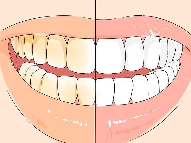 1. Dişlerinizi diş hekimine temizletmediğiniz durumlarda tartarlar plak oluşturur.