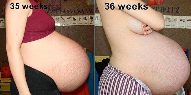 Hamilelik Döneminde Çekilen 19 Fotoğrafla; Bir Üçüz Doğurma Hikayesi