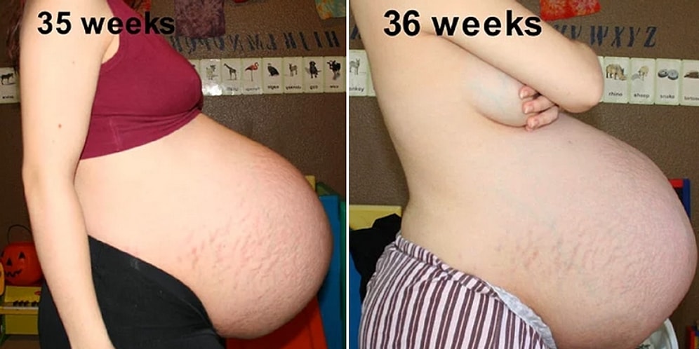 Hamilelik Döneminde Çekilen 19 Fotoğrafla; Bir Üçüz Doğurma Hikayesi