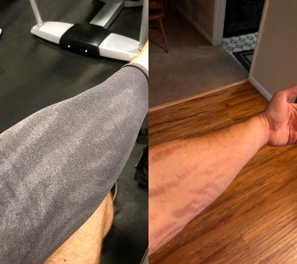 17. Вы знали, что шрамы не потеют?!