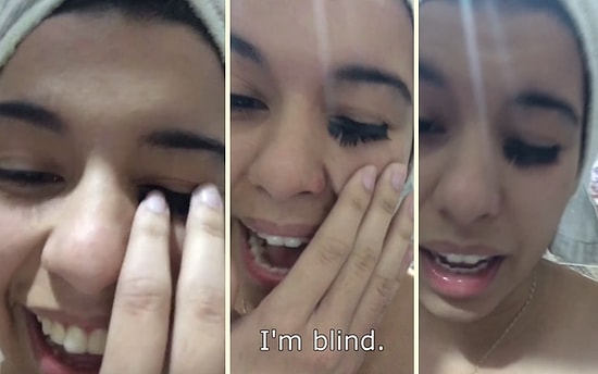 Takma Kirpikleri Yanlış Yapıştırıcı ile Yapıştıran Kadının Dramı