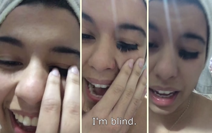 Takma Kirpikleri Yanlış Yapıştırıcı ile Yapıştıran Kadının Dramı