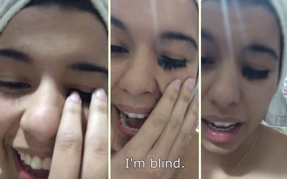 Takma Kirpikleri Yanlış Yapıştırıcı ile Yapıştıran Kadının Dramı