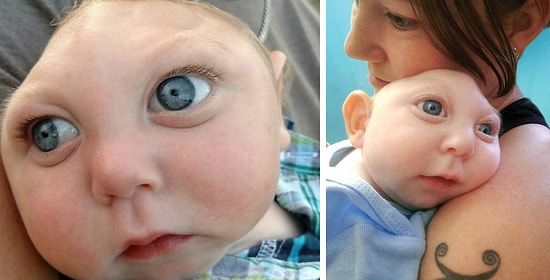 Малыш родился без 80% мозга. Врачи сказали, что он не проживет и часа, а сейчас ему уже 3 года!