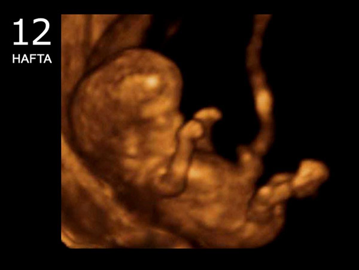 12 недель и 1 день. Эмбрион на 12 неделе беременности УЗИ. 3д УЗИ на 12 неделе беременности. Снимок УЗИ на 12 неделе беременности. УЗИ малыша на 12 неделе беременности фото.
