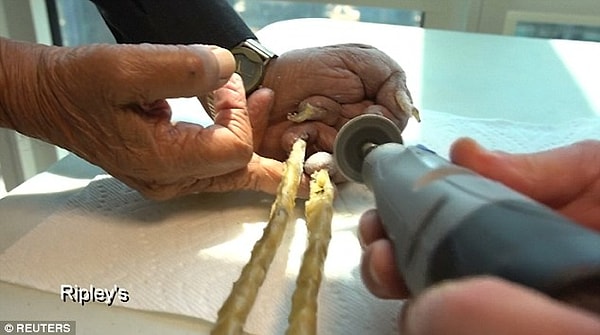 4. Самый длинный ноготь был на большом пальце, его длина составляла 197,9 см.