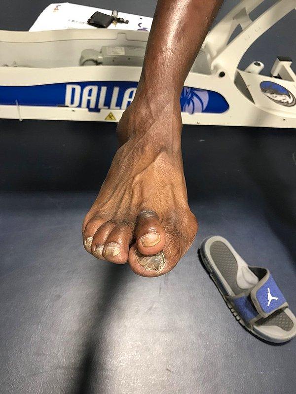 14. Darrell Armstrong gibi çok uzun boylu basketbolcular, sıklıkla ayaklarının ağrılarından şikayet ederler.