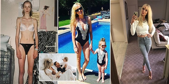 Anoreksiya Hastalığını Yenip Aile Kuran Güçlü Kadının Umut Verici Hikayesi