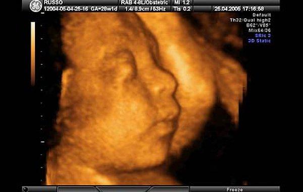 Hamilelikte 28. haftada bebeğinizin rüya görmesini sağlayan dalgalara rastlanmaktadır.