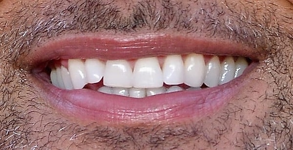 11. И, наконец, чья это улыбка?