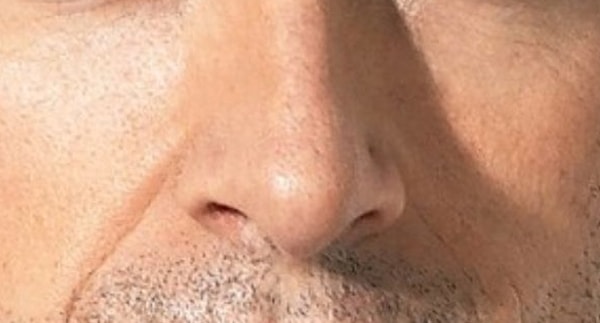 7. А кому из представителей сильного пола принадлежит этот нос?