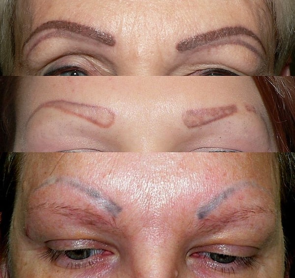 17. А вот как неудачный татуаж выглядит через несколько лет