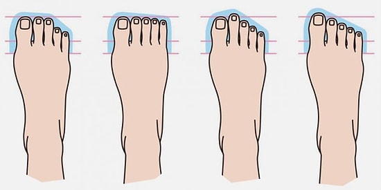 Тест: по форме пальцев на ноге определим, кем были ваши предки