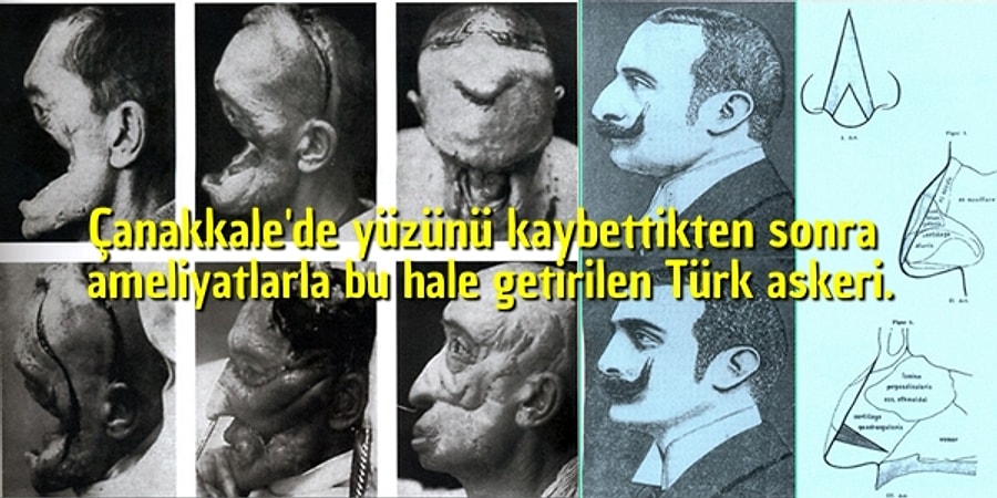 Prof Dr Emrah Arslan Yorumlari Incele Ve Randevu Al Doktortakvimi Com