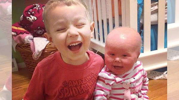 5. После того, как все анализы были сданы, малышке Бренне был поставлен диагноз