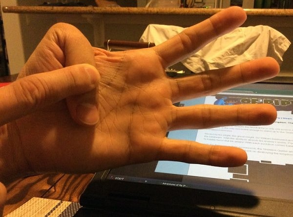 11. "Я и не знал, что это не норма"