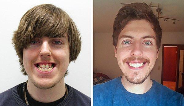 18. "Bugün diş tellerim çıkarıldı. 28 yıldır ilk kez gülerken utanmıyorum."