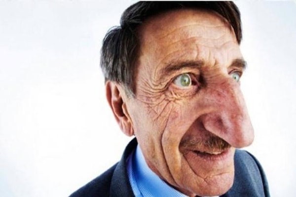 8. Стеснялся своего носа