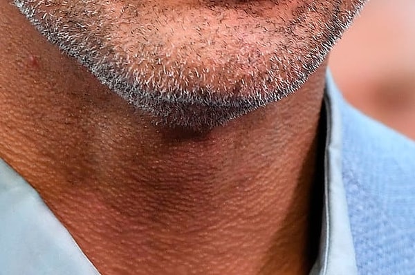 5. Вы знаете, чей это подбородок!