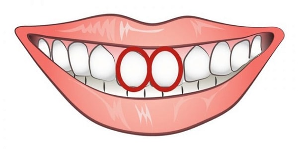 Резцы овальной формы