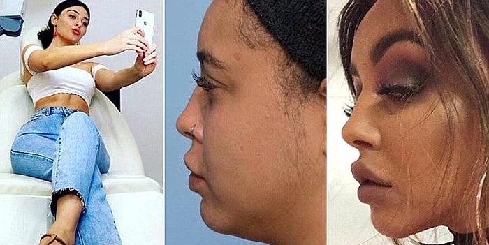 Куда катится мир? Девушки решаются на пластику, чтобы красиво выглядеть на селфи