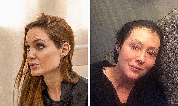 4. Angelina Jolie and Shannen Doherty: Mastektomi (meme ameliyatı)