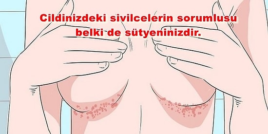 Sütyenini Sık Yıkamadığında Başına Gelebileceklerden Haberin Var mı?