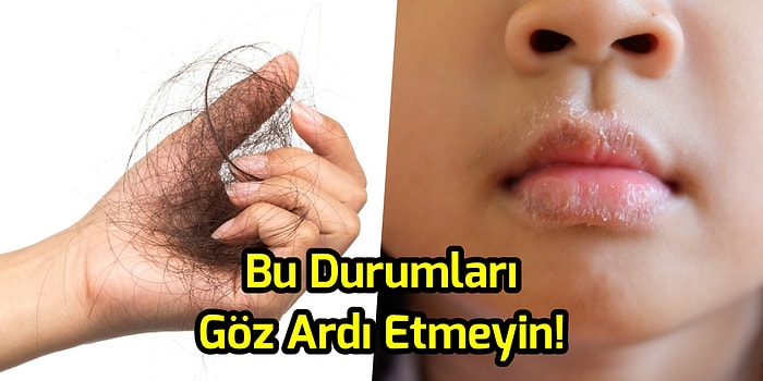 Bu Durumları Yaşıyorsanız Dikkatli Olun! Basit Gibi Görünüp Ciddi Hastalıkların Habercisi Olabilecek 10 Belirti