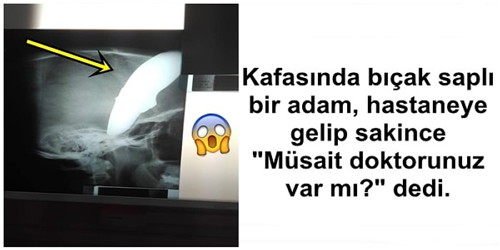 Kafasında 15 Santimetrelik Bir Bıçakla Hastaneye Giden Adam Doktorlardan Kibarca Yardım İstedi!