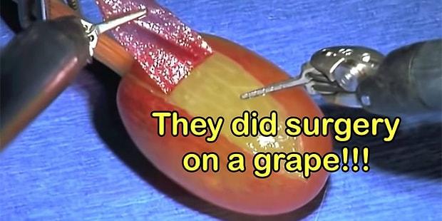 The Story Behind ‘They Did Surgery On A Grape’ Memes That Brought The House Down!