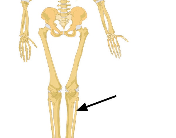 13. Что насчет этой кости?