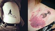 16 классных примеров того, как с помощью татуировки можно спрятать любой дефект