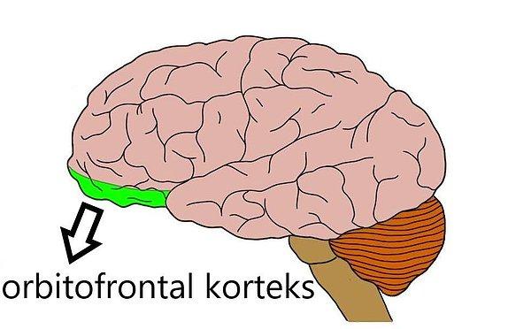 Yaniiii, araştırmaya göre lateral orbitofrontal korteksin elektrikle uyarımı, depresyon hastalarında iyileşme sağlıyor.