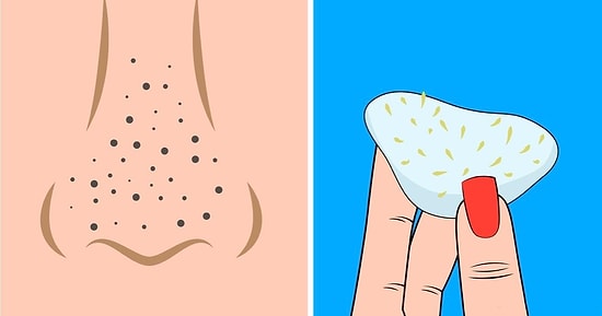 Откуда берутся расширенные поры и как избавиться от них раз и навсегда: подробный гид