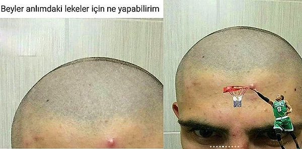 3. "Друзья, что можно сделать с этими пятнами на лбу?"