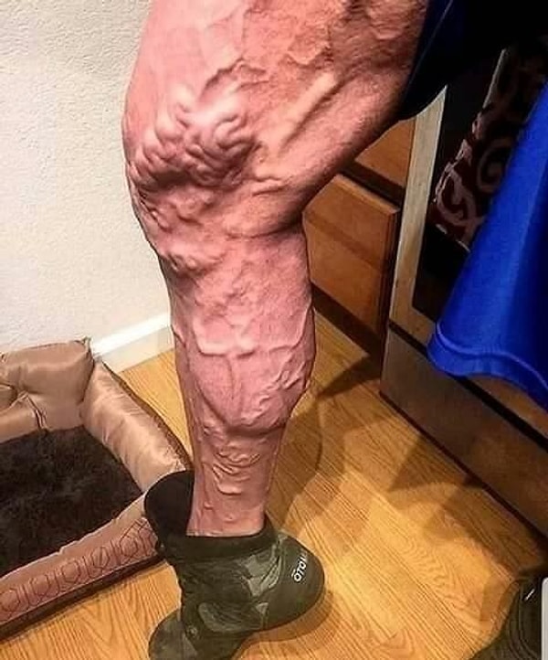 10. Это как же надо было качать ноги?