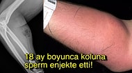 Her Derde Deva Olduğunu Düşündüğü İçin 18 Ay Boyunca Kendisine Sperm Enjekte Eden Adam!
