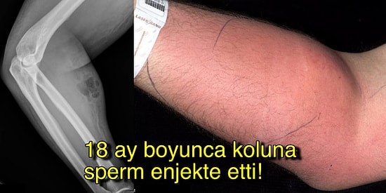 Her Derde Deva Olduğunu Düşündüğü İçin 18 Ay Boyunca Kendisine Sperm Enjekte Eden Adam!
